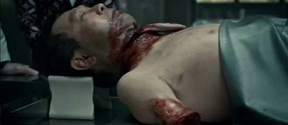 Der Tote mit der schaurigen %26bdquo;Necktie%26ldquo; ist ein Opfer des wahren %26bdquo;Chesapeake Ripper%26ldquo;; aka Hannibal (Mads Mikkelsen). &copy; NBC