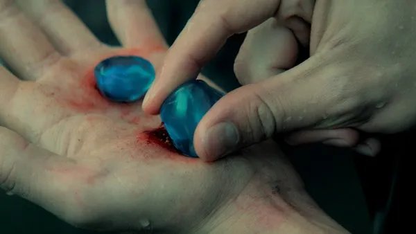 Die Elfstones sind dermatologisch nicht zu empfehlen. © MTV