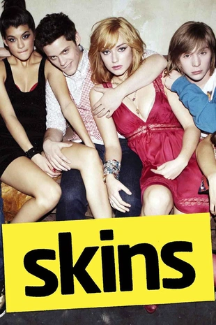 Skins (US) Poster